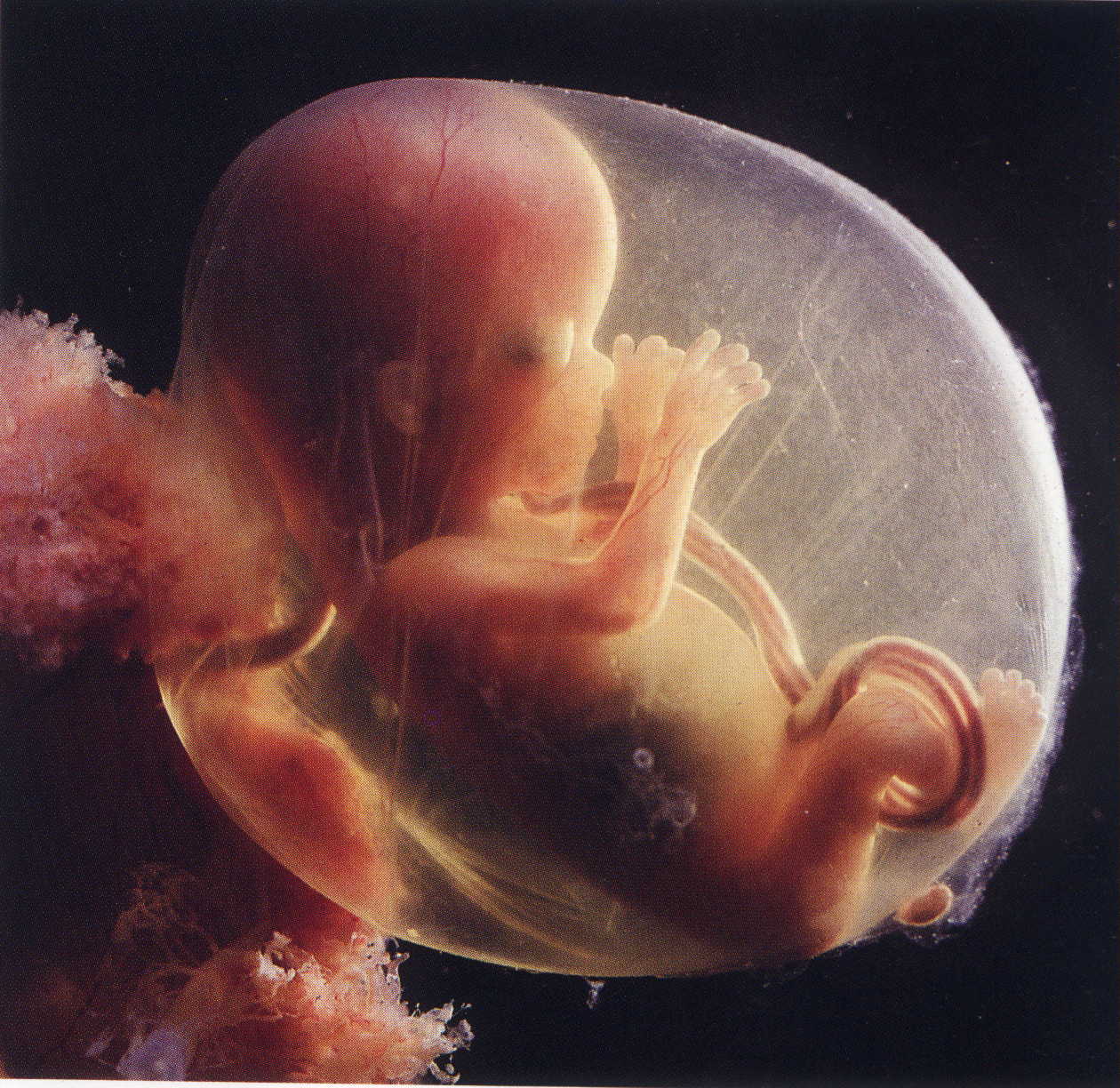 Een foetus in de baarmoeder 